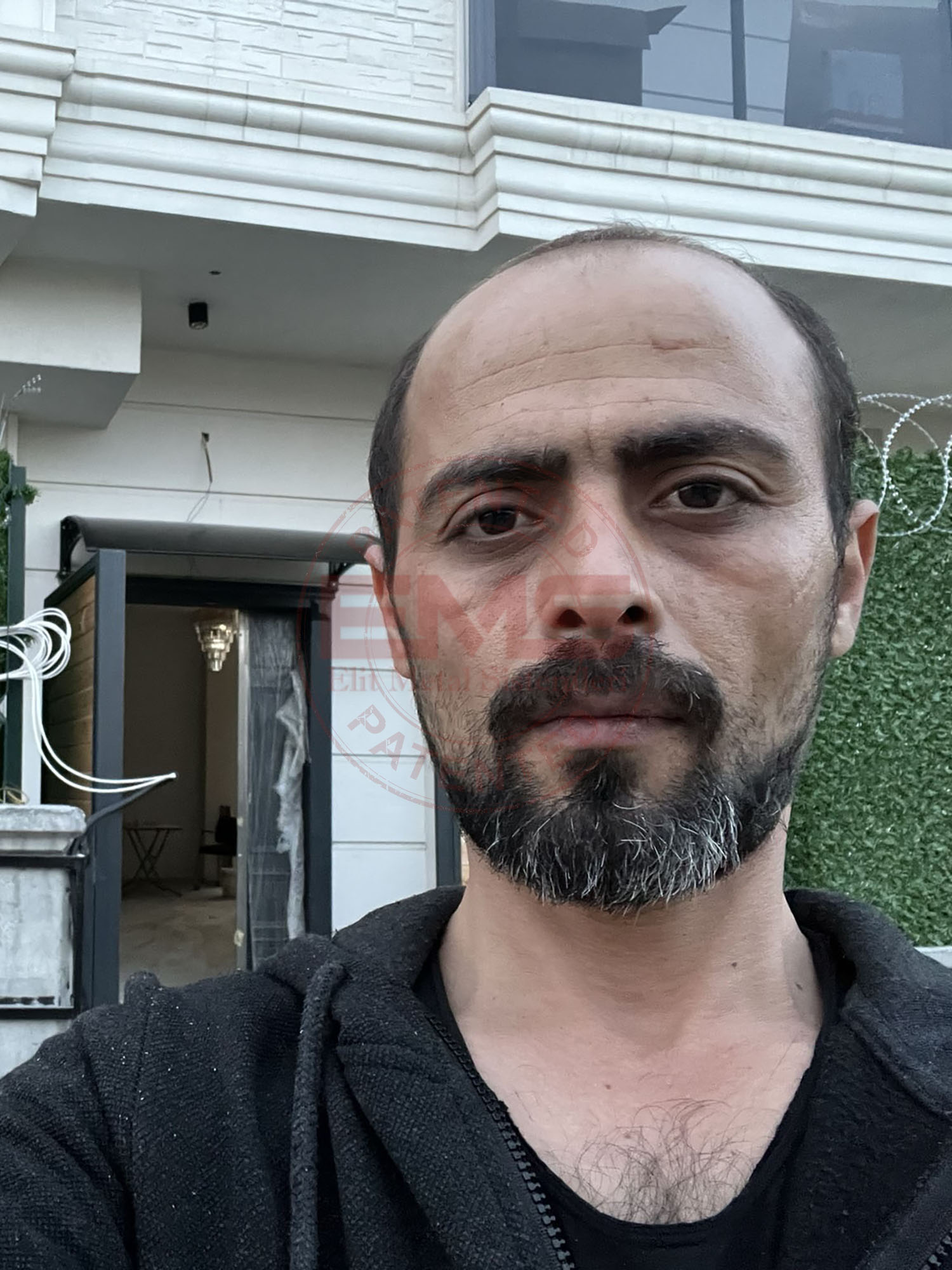 ElitMetalSistemleri-Turgay-Bey-Ahsap-Kapi-Uretim-Montaj- (19)